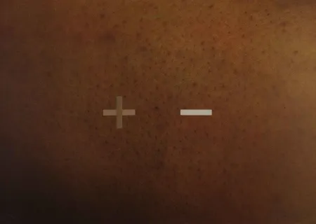 Siebdruck Dias - S.T.