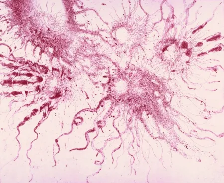 Radierung Und Aquatinta Barcelo - Lanzarote 20