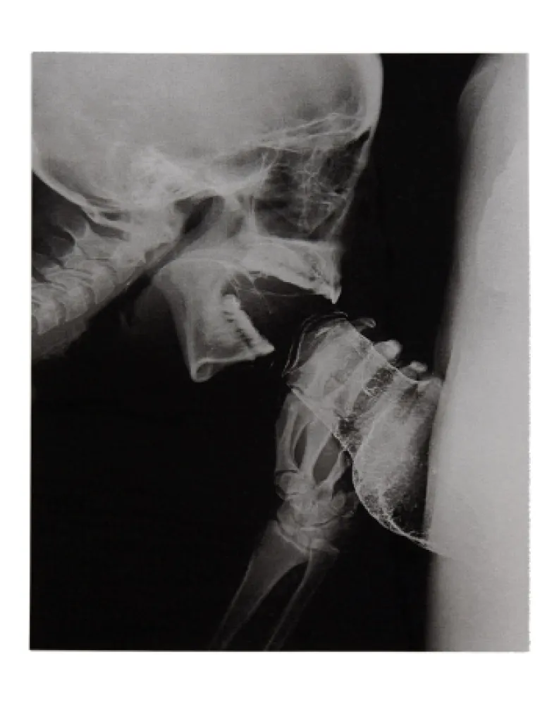 Illustriertes Buch Delvoye - Sexrays