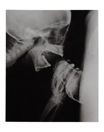 Illustriertes Buch Delvoye - Sexrays