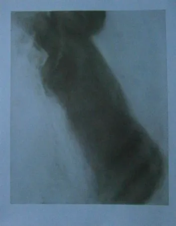 Radierung Garache - Bleue