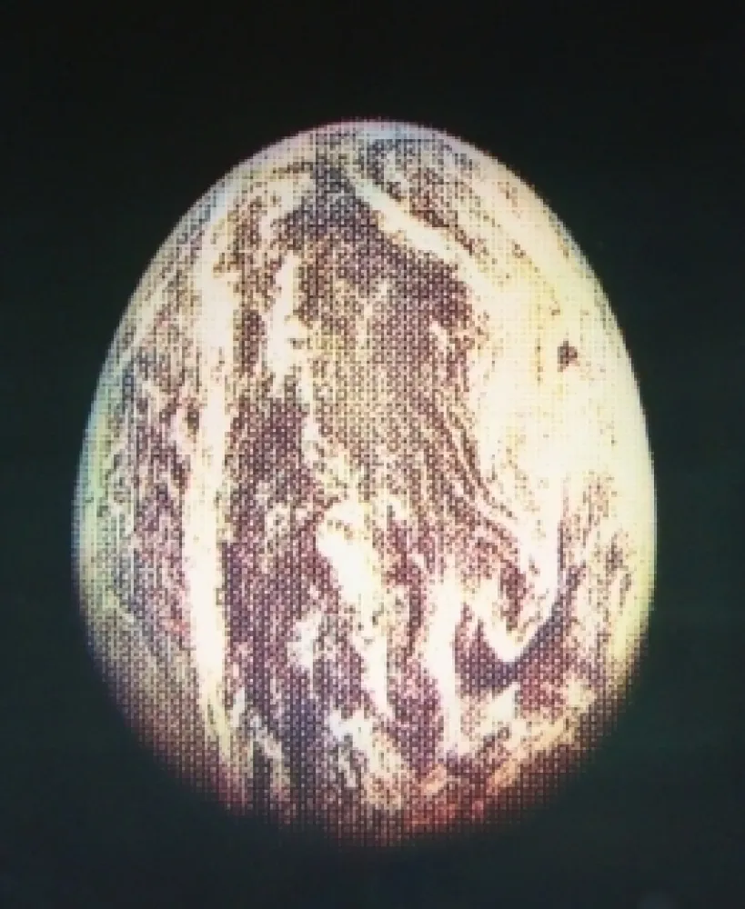 Radierung Und Aquatinta Jacquet - L'oeuf