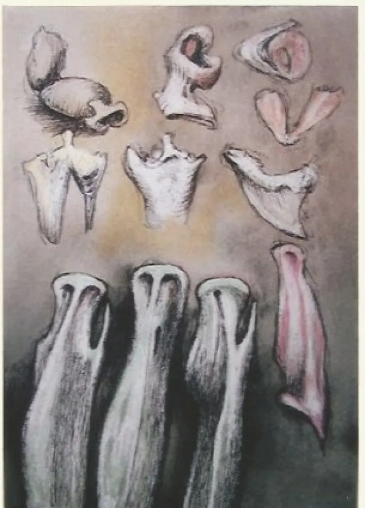 Lithographie Moore - Tree sisters